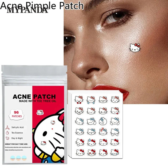 96/100/120 Patches Sanrio Hello Kitty Kuromi Acne Patches Removal Pimple Patches Spots Marks Concealer Repair Sticker Waterproof